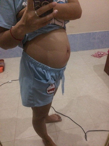 การบำรุงครรภ์