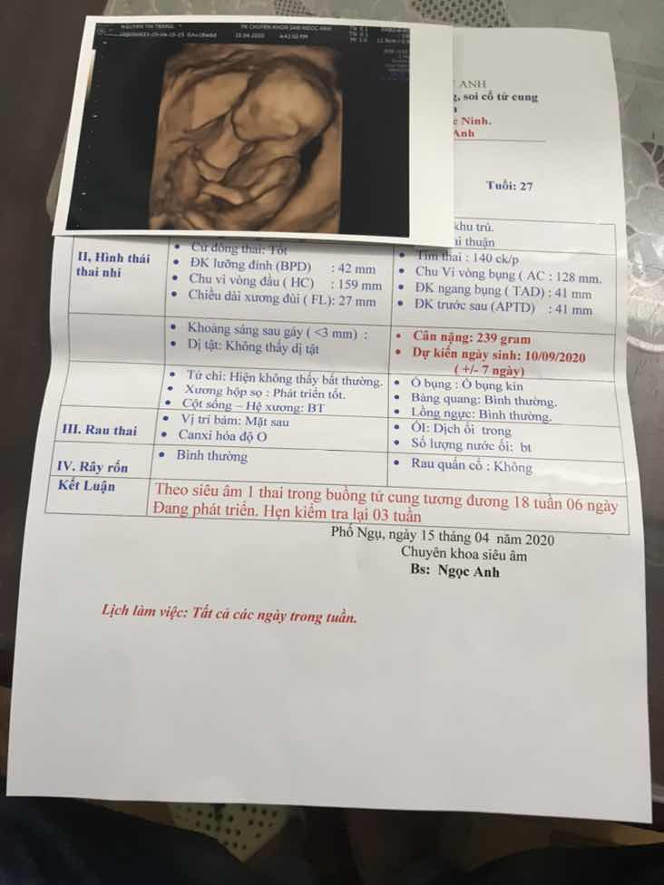 Công chúa yêu