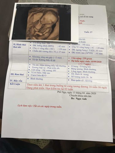 Công chúa yêu