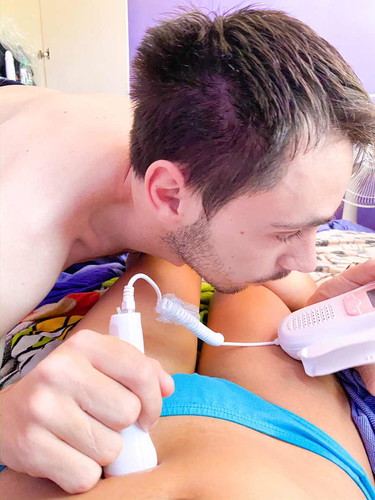 Fetal doppler