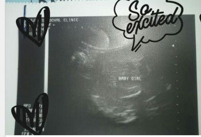 ULTRASOUND.