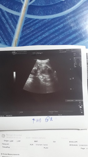 เพศลูก