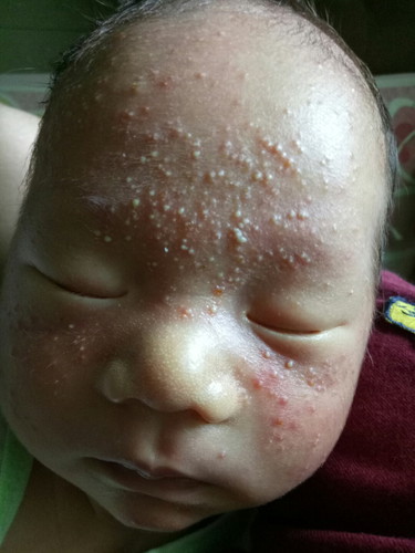 แม่บ้านไหนเคยเจอแบบนี้บ้างคะ..แม่สงสารลูกมากเลยจ้า