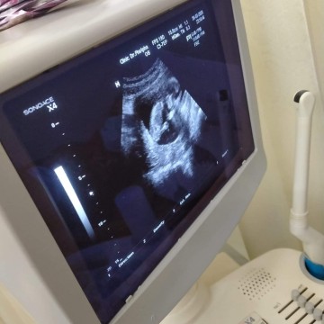 13w4d+10d