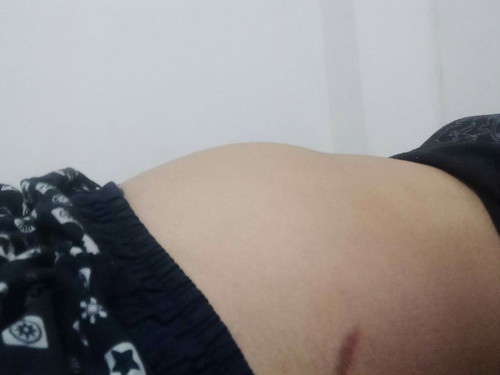 ท้องเล็กไปหรือป่าวค่ะ