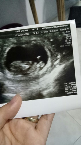 USG KE 2 . KEHAMILAN KE 2