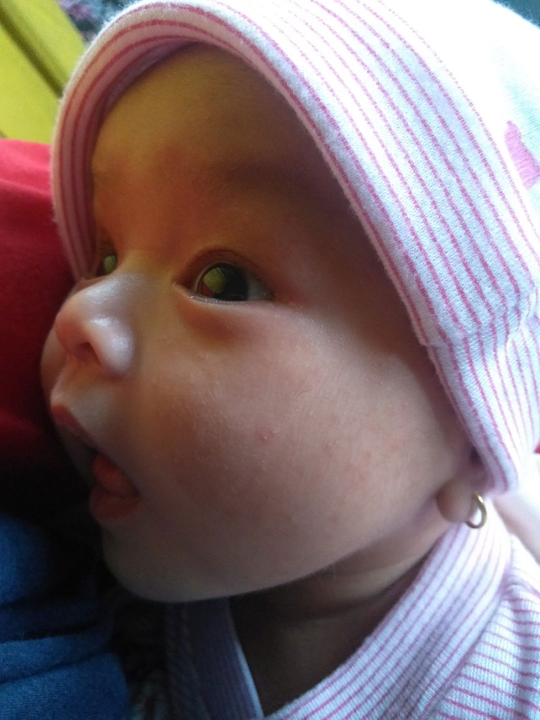 bintik merah/jerawat dipipi