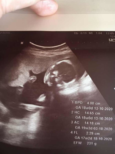 17W+2