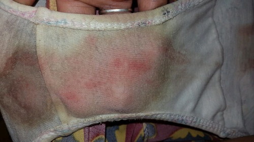 ask lng po ako... 3 months wala akong mens then sabi nga hilot samin 3months na din daw akong buntis then ngayon sumasakit tyan ko then may dugo na lumabas...