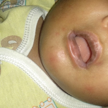 bibir bayi