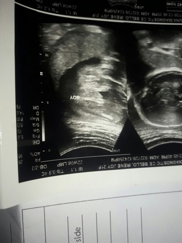baby boy0