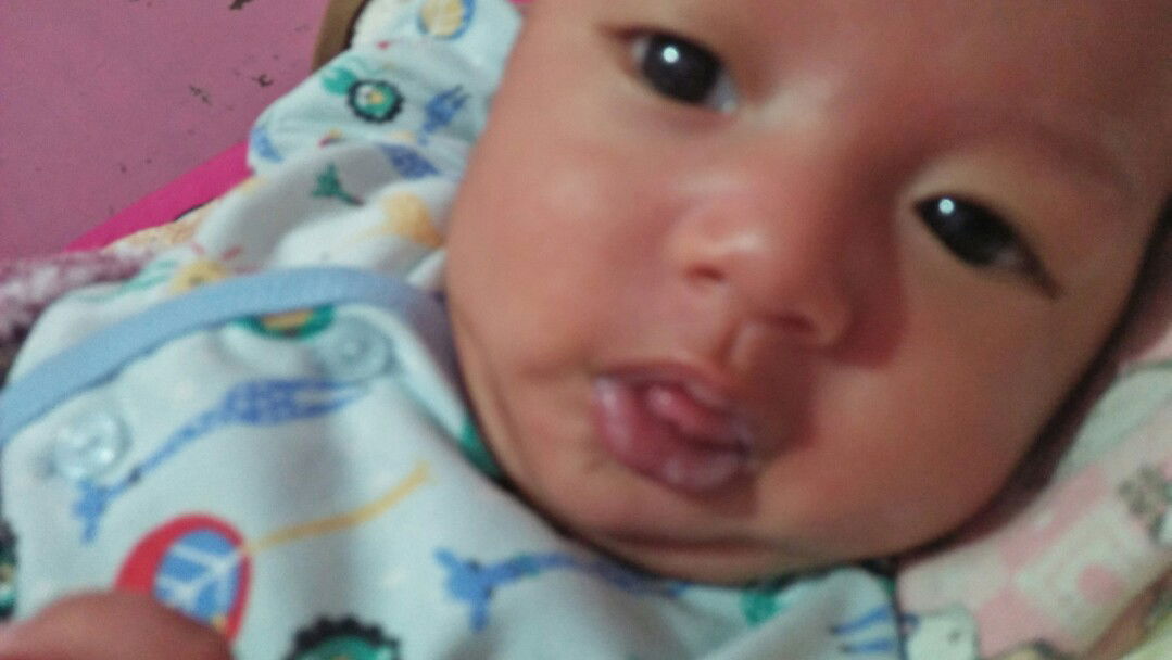 bibir bayi pecah pecah