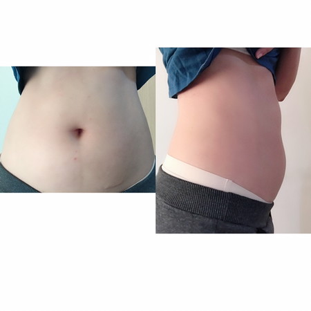 ท้องแรกคลอดเดือนตุลาคม63ค่ะ