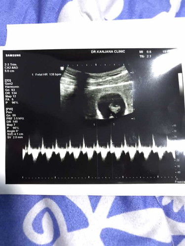 8W ไม่แพ้ท้องไม่มีอาการนอกจากเวียนหัว ถือว่าปกติไหมคะ