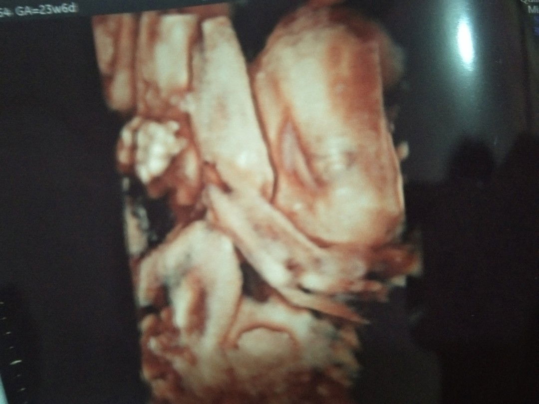 6เดือนแล้วได้ลูกสาวคร้าแต่เหมือนพ่อหมดเลย