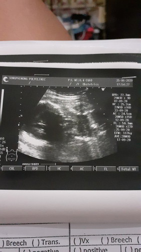 ยังไม่7เดือนลูกกลับหัวแล้ว