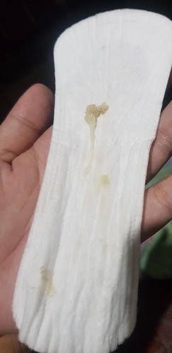 DISCHARGE at 38weeks