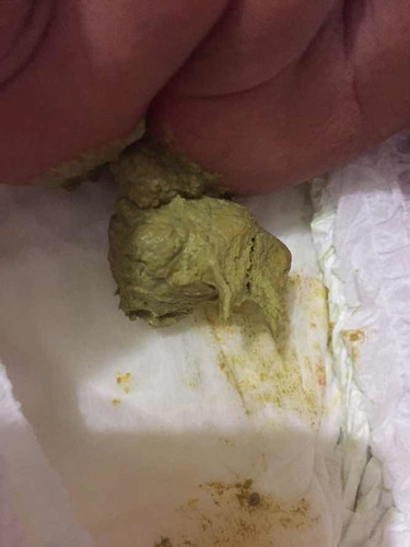 ลูกกินนมผงค่ะ