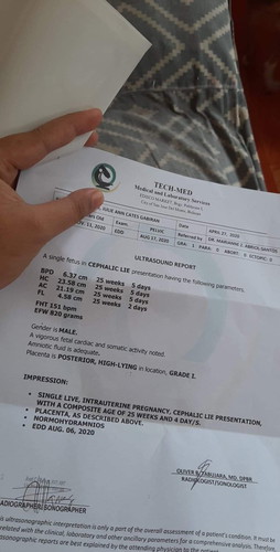 Normal lang po ba?