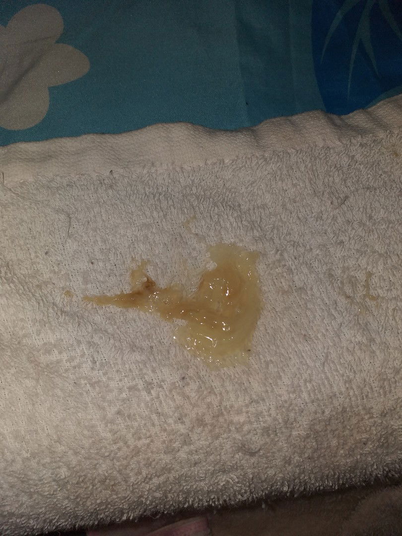 38+1มีมูกออกแบบนี้มาสามวันแล้ว