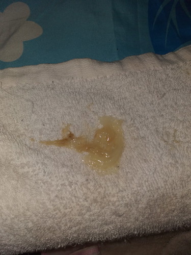 38+1มีมูกออกแบบนี้มาสามวันแล้ว