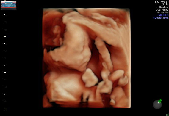 Malla Mariska profile icon