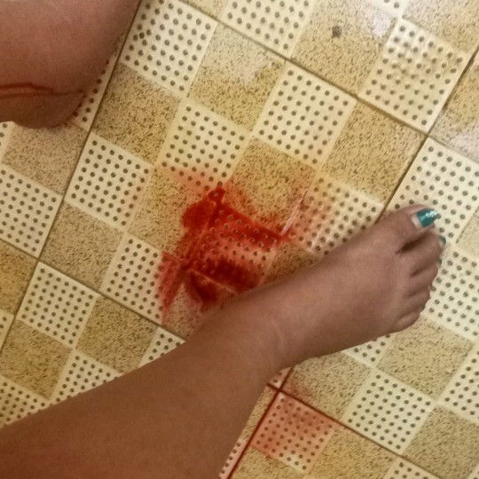 keluar darah segar tiba²..