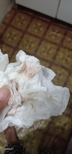 flek saat hamil muda