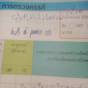 สงสัย
