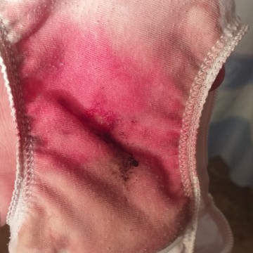 implantation bleeding po ba or period po siya?