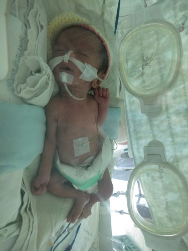 ครรภ์เป็นพิษ