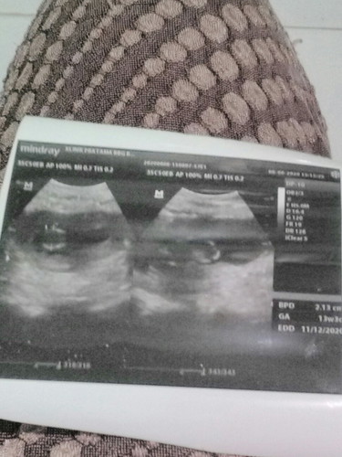 hasil USG