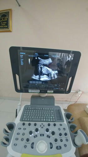 jenis kelamin janin