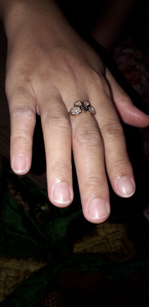 tangan gatal2
