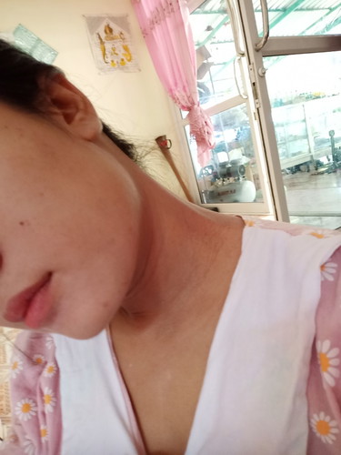 คอดำ รักเเร้ ดำ