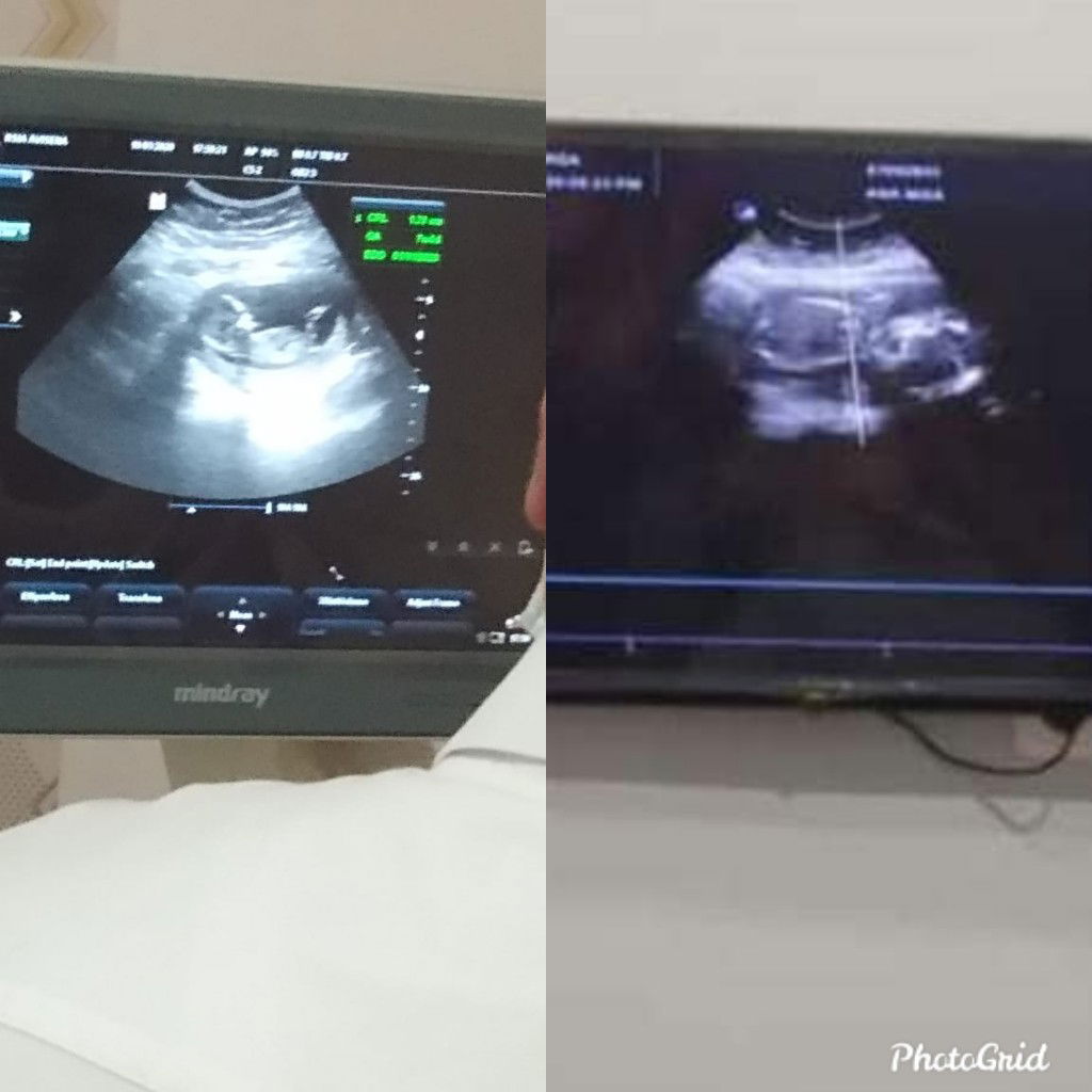 Ana Anisah profile icon