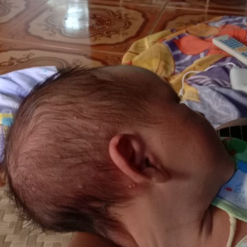 kepala bnyak bentol putih
