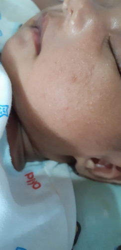 bayi