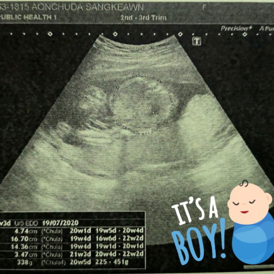 สอบถามเกี่ยวกับอายุครรภ์​ค่ะ