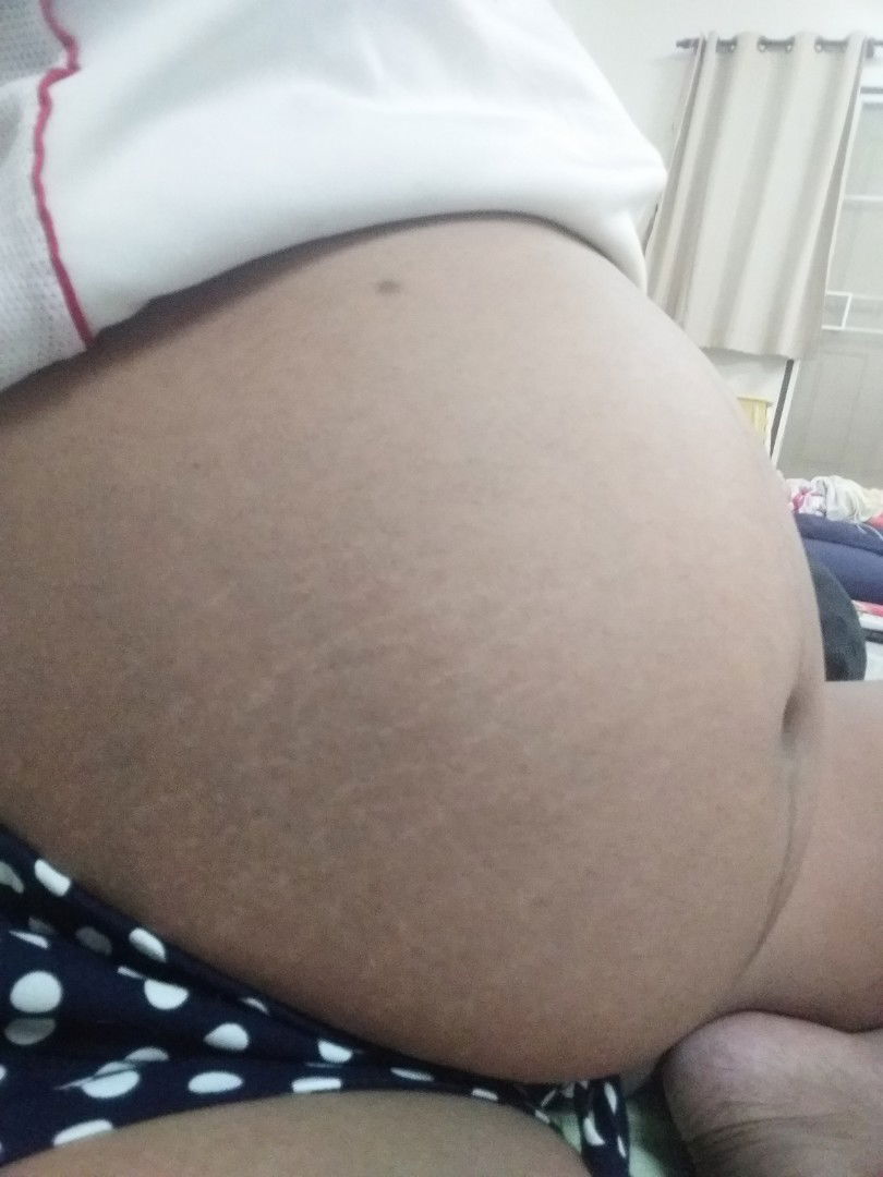 เจ็บลิ้นปี่มากๆ