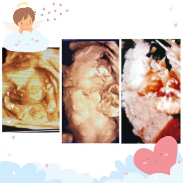 อวดน้ำหนักลูกกันหน่อย?