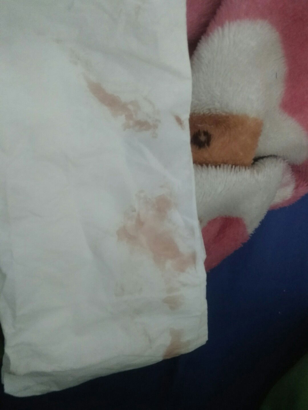 ปวดท้องมาก เลือดออก