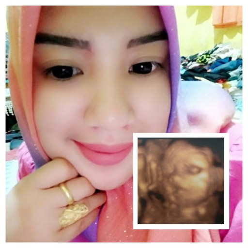 Sarah Putry Anjelika profile icon