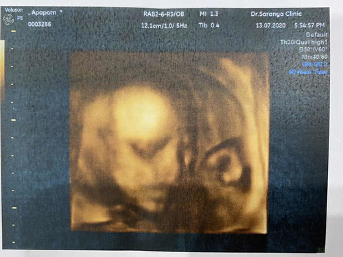 โครงหน้าจะชัดกว่านี้