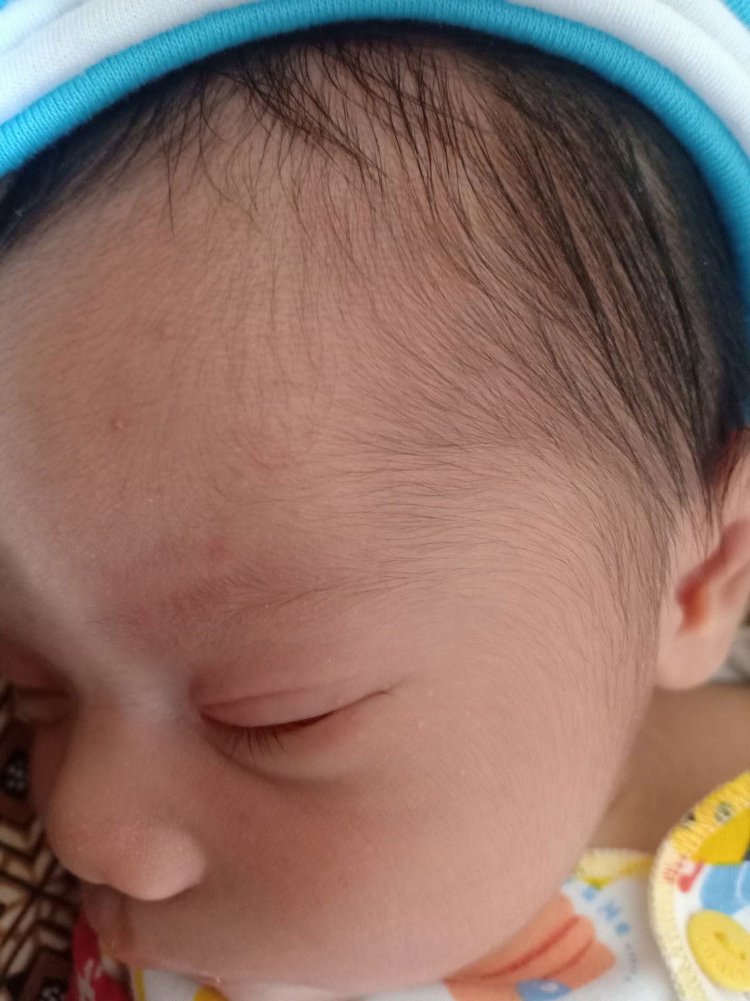 problem pda kulit bayi baru lahir