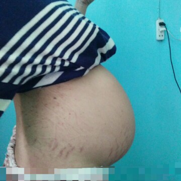 38weeks 3days