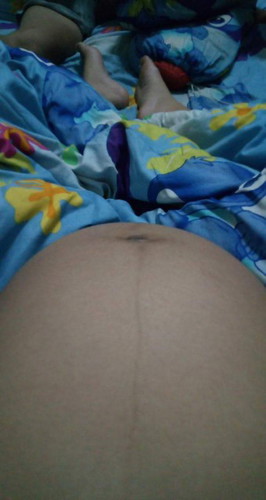 อยากปรึกษาค่ะ