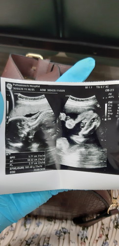 วันนี้เจาะเลือดไป3รอบ