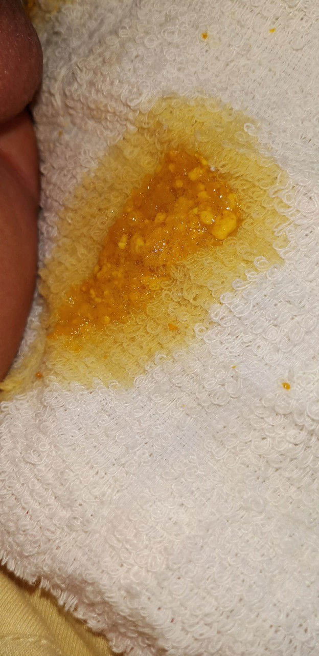 Mom giúp e vs ạ..e tập đầu nên không biết