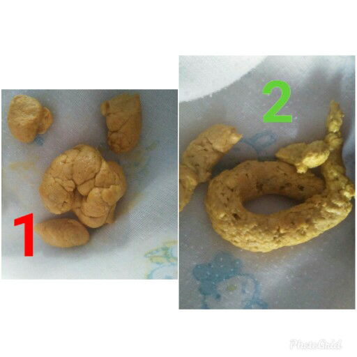 น้องอึวันละสองรอบต่อวัน แบบนี้ปกติไหมคะ